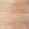 Clinique Smart Clinical Repair Wrinkle Correcting Rich Cream 50ml
