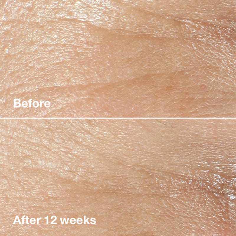 Clinique Smart Clinical Repair Wrinkle Correcting Rich Cream 50ml