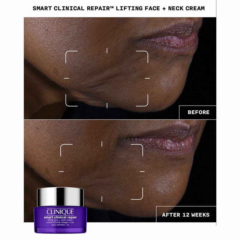 Clinique Smart Clinical Repair Lifting Face + Neck Cream 50ml