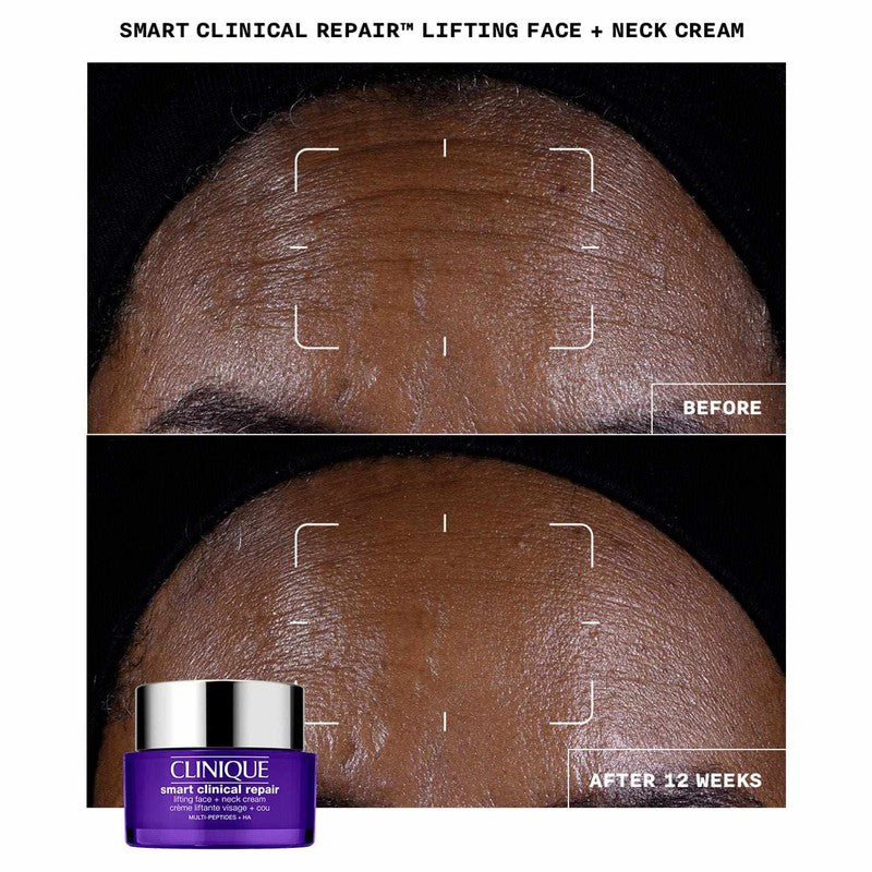 Clinique Smart Clinical Repair Lifting Face + Neck Cream 50ml