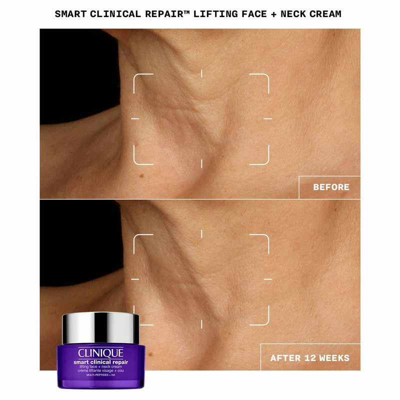 Clinique Smart Clinical Repair Lifting Face + Neck Cream 50ml