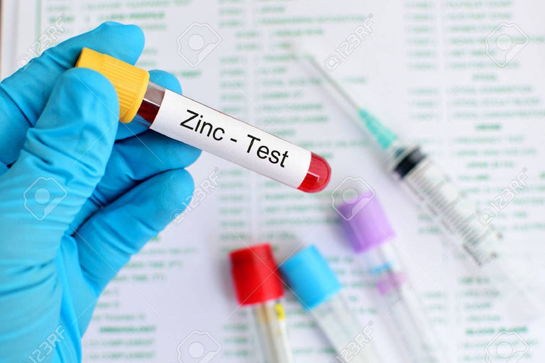 Zinc Test