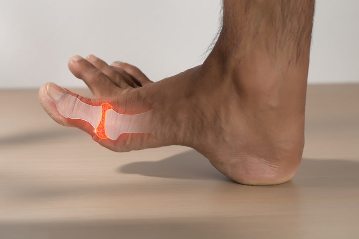 Gout Management and Education Consult