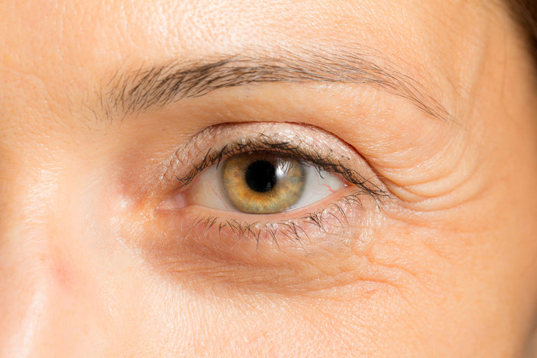 Crows Feet