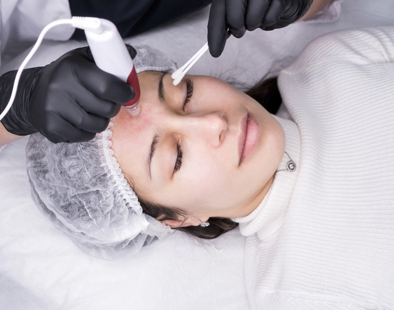 Pro Micro Needling
