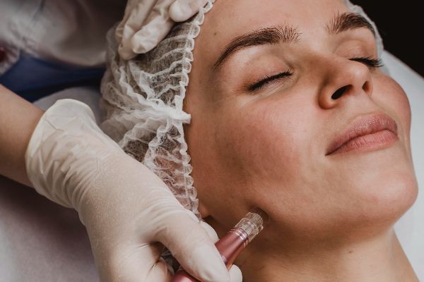 Microdermabrasion