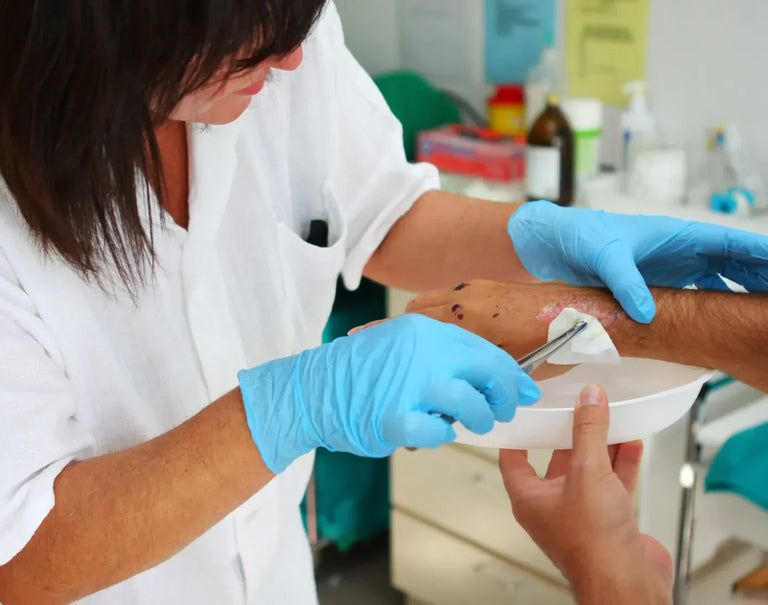 Wound Treatment