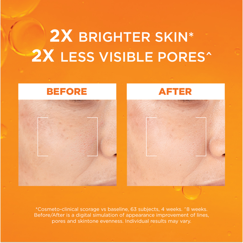 L'Oréal Paris Revitalift Clinical Vitamin C Serum 30ml